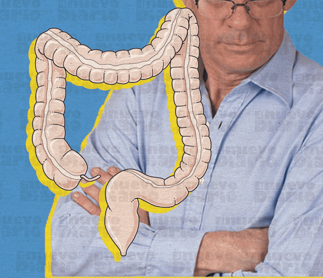 Cáncer de colon en jóvenes de NYC: La comunidad dominicana en alerta Cáncer de colon en jóvenes de NYC: La comunidad dominicana